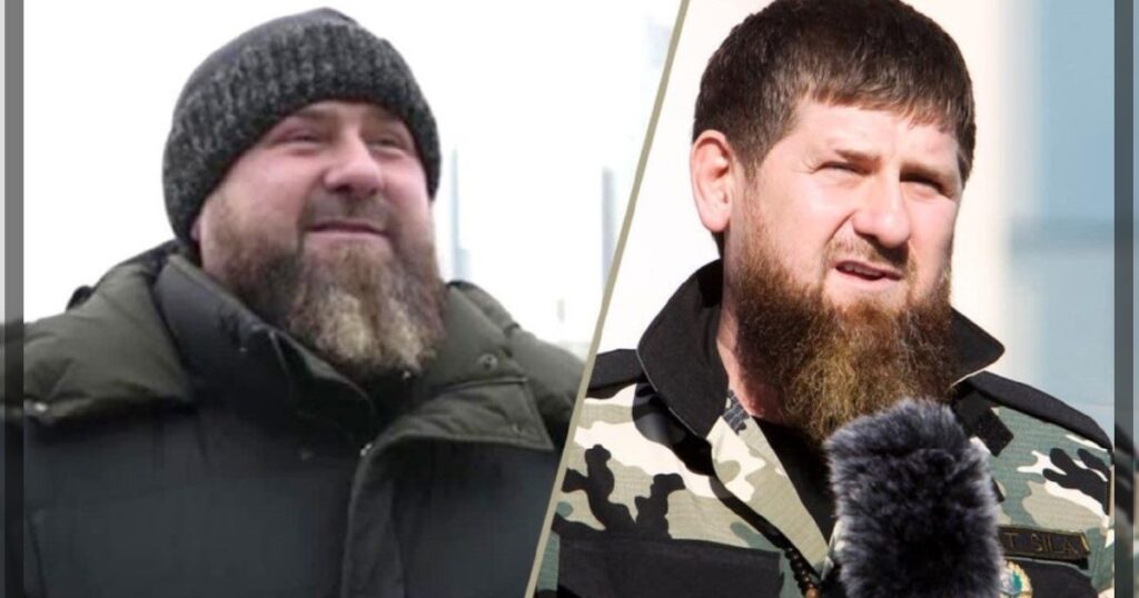 Украинские СМИ со ссылкой на свои источники распространяют информацию о том, что у Кадырова якобы отказали почки.